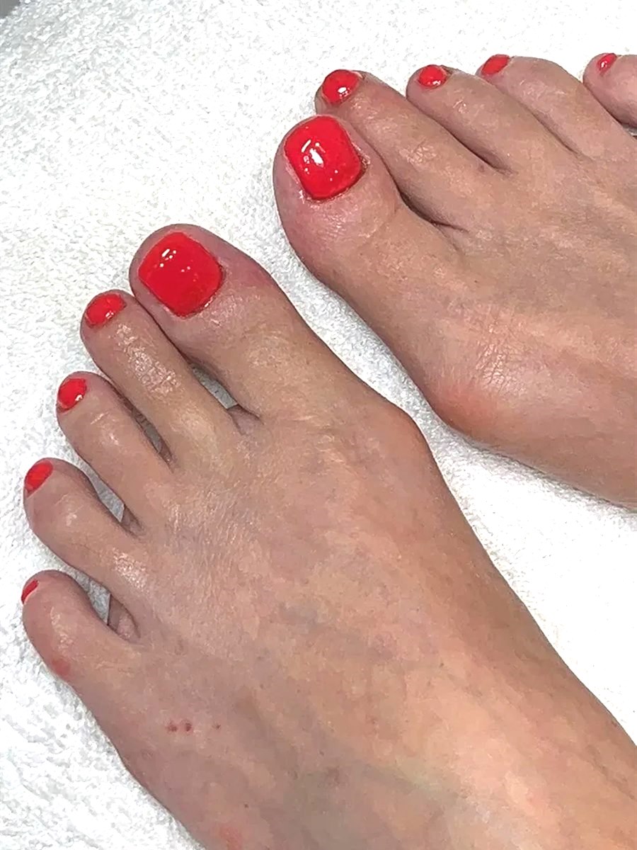 The same client's toenails after a Nail Restore Pedicure